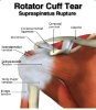 Picture of (LARGE) Shoulder T-Shellz - Use on Either The Left or Right Shoulder!