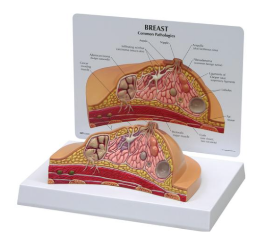 Picture of Breast Cross-Section Model