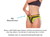 Picture of Pelvic Pro | Patented Uterus Prolapse Support Belt for Dropped Bladder or Cervix, Vulvar Varicosities & SPD